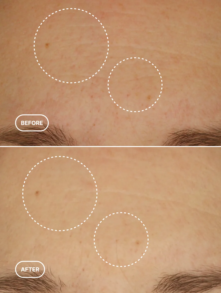 Retinol-Alternative serum